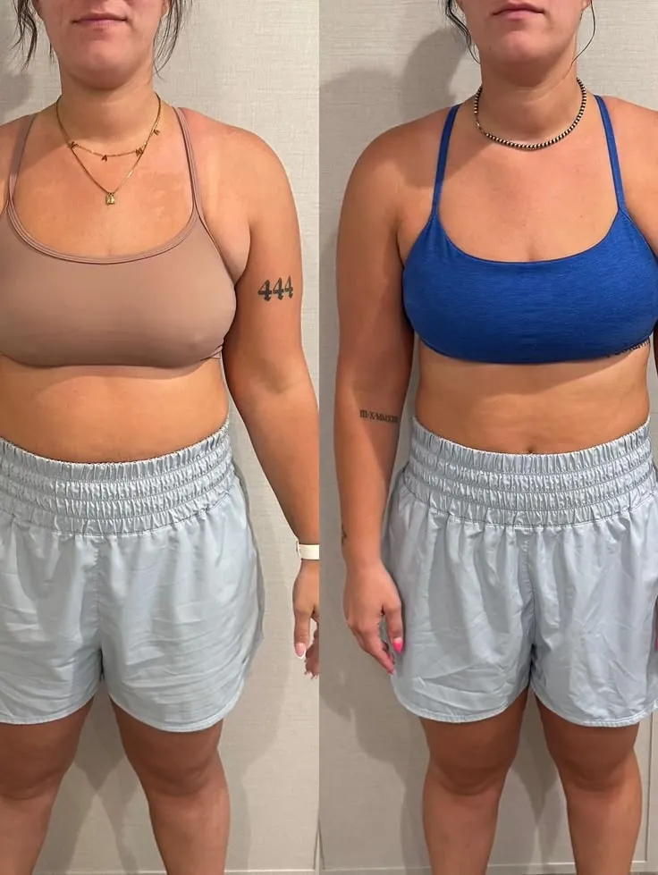 A woman's progress shown from the front in two side by side photos